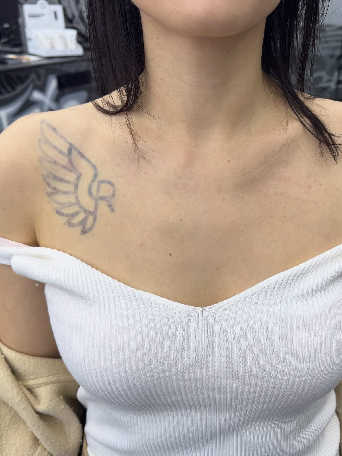 Vor dem Cover-up — altes, per Laser aufgehelltes Tauben-Tattoo und Narbe auf der Brust, Wrocław